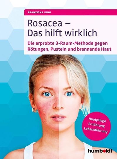 Image sur Ring, Franziska: Rosacea - Das hilft wirklich